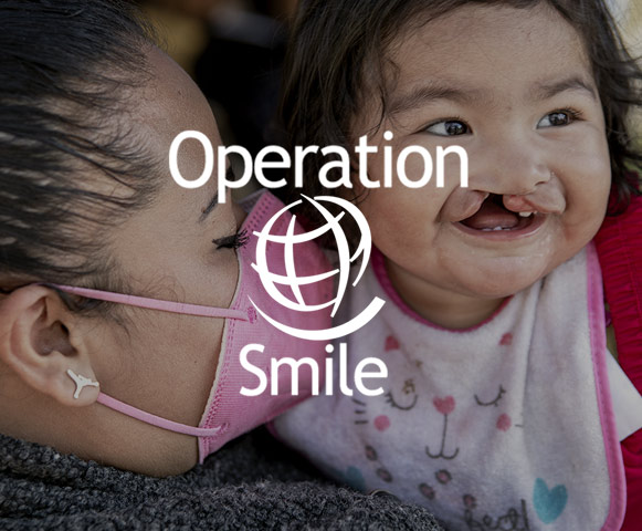 Operation smile